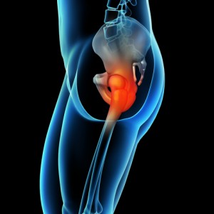 Hip Pain That Radiating Down the Leg: Causes and Management