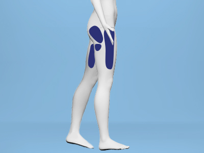 Side hip pain