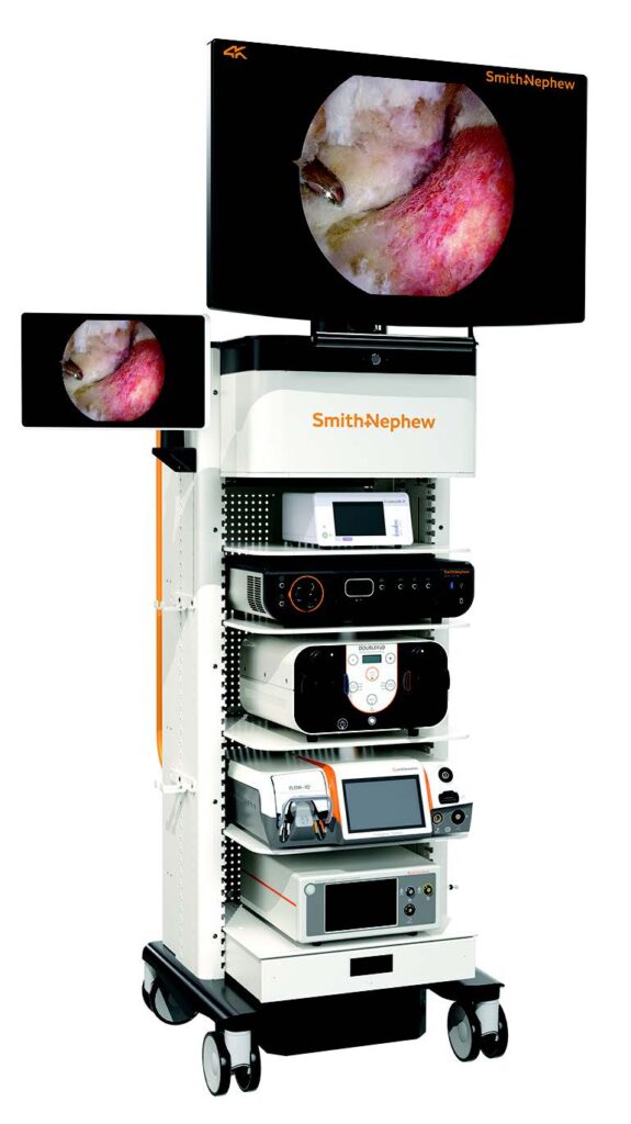 Smith and Nephew Intellio Tower