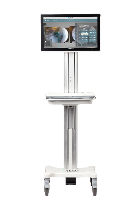 Velys Hip Nav Equipment