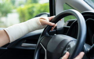 how long after surgery can you drive