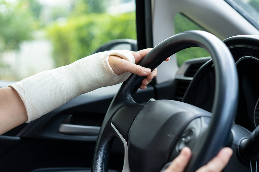 how long after surgery can you drive